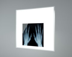 Світильник світлодіодний медичний рентгенний АG Ultra 825х525х100 мм 50 Вт (8854)